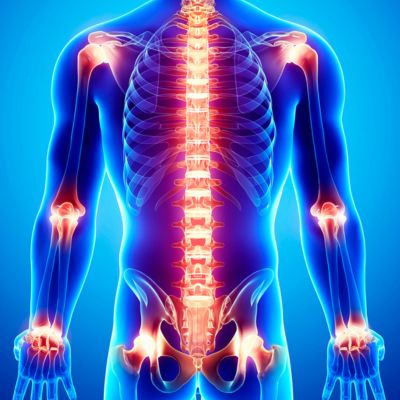 Joint Pains
